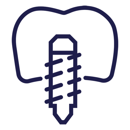 Cấy Ghép Implant